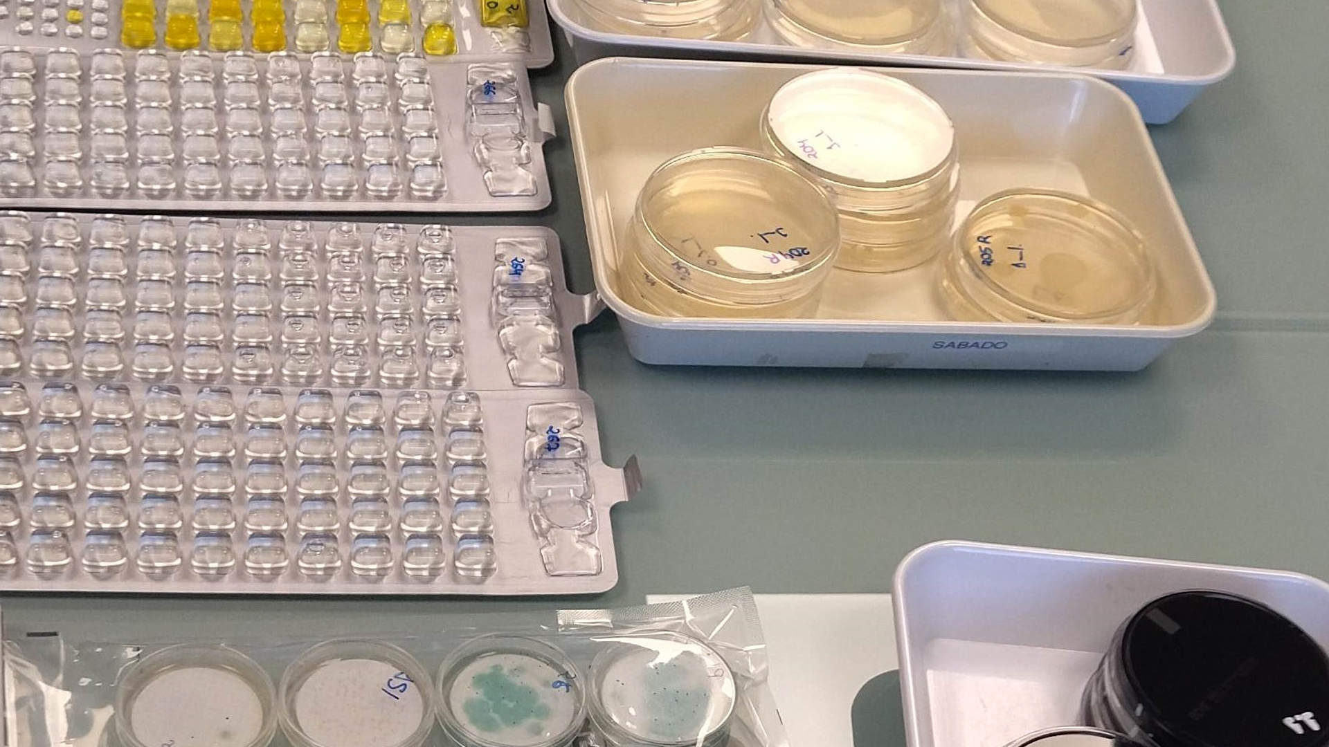 cenifer Resultados de análisis microbiológicos del agua